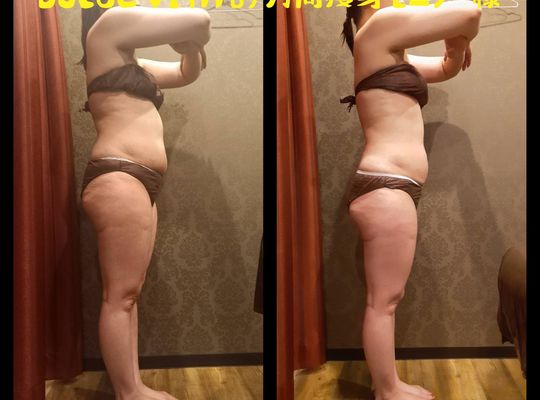 福岡市早良区野芥のエステサロンドルチェヴィータ★痩身モニター様結果報告