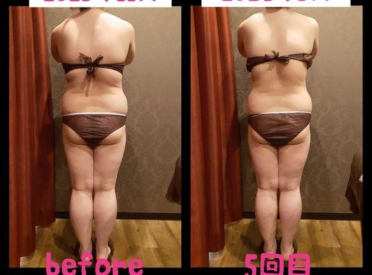 福岡市早良区野芥のエステサロンドルチェヴィータ★痩身ダイエットモニター様ビフォーアフター写真