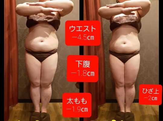 福岡市早良区野芥のエステサロンドルチェヴィータ★痩身ダイエットモニター様ビフォーアフター