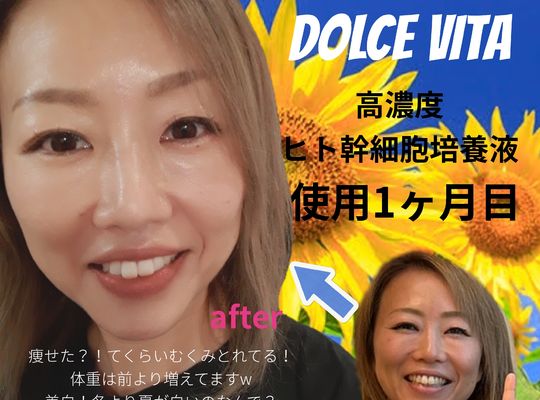 福岡市早良区野芥のエステサロンドルチェヴィータ★使用1ヶ月経過報告！