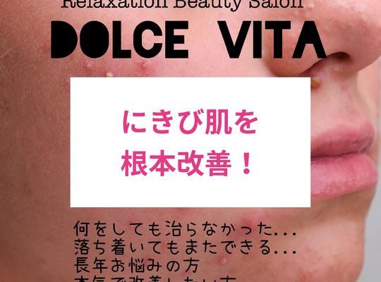 福岡市早良区野芥のエステサロンドルチェヴィータ★にきび改善