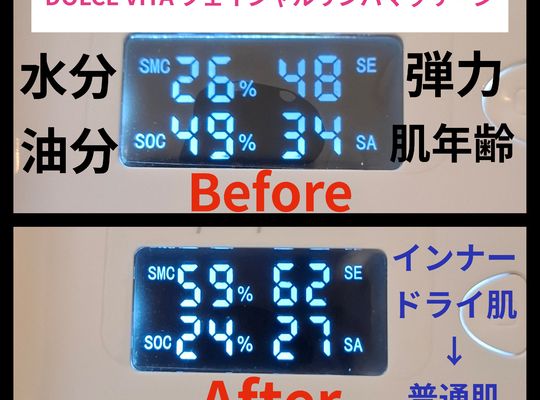 福岡市早良区ドルチェヴィータ★フェイシャルリンパマッサージ