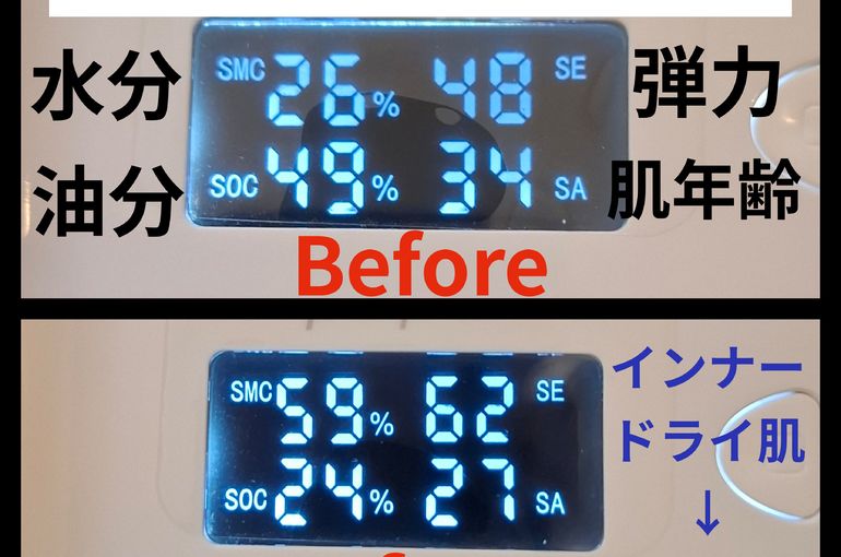 福岡市早良区ドルチェヴィータ★フェイシャルリンパマッサージ