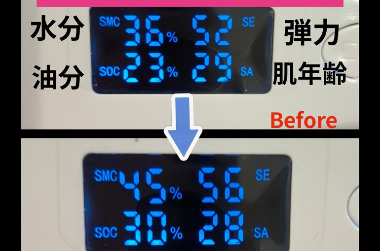 福岡市早良区ドルチェヴィータ★人気No.1メニュー高濃度ヒト幹細胞培養液導入