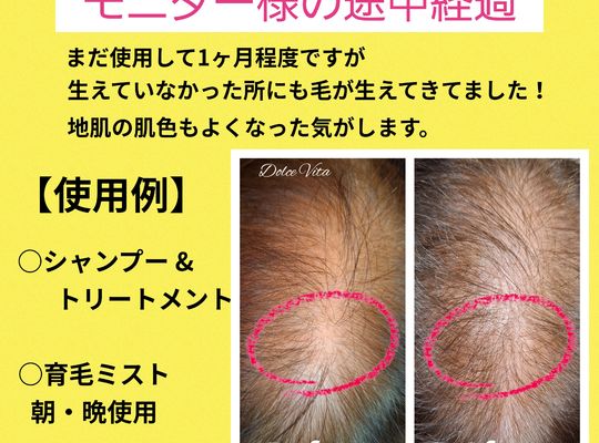 福岡市早良区ドルチェヴィータ★スカルプケアシリーズを試した結果