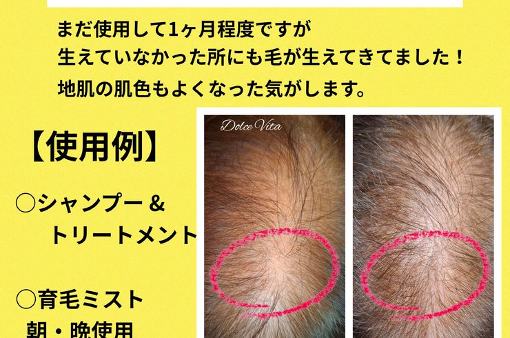 福岡市早良区ドルチェヴィータ★スカルプケアシリーズを試した結果