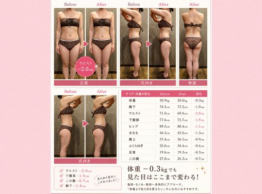 福岡市早良区【エステ】ドルチェヴィータ★痩身エステビフォーアフター