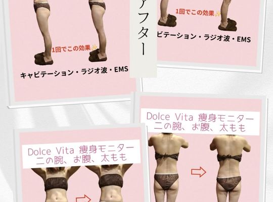 福岡市早良区【エステ】ドルチェヴィータ★【痩身モニター】1回でここまで変化♡ ビフォーアフター公開！