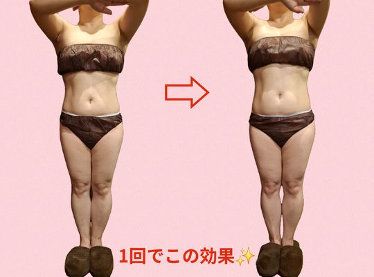 福岡市早良区【エステ】ドルチェヴィータ★1回でここまで変わる？！上半身ダイエットモニター