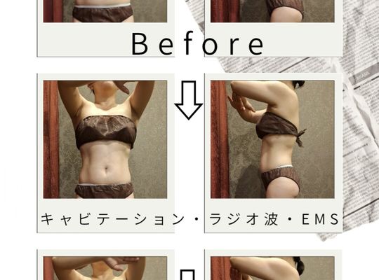 福岡市早良区【エステ】ドルチェヴィータ★上半身のみ痩身コース2回目でここまで変わる？！